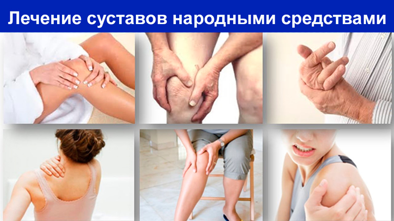 Изображение - Лечение суставов народными средствами lechenie-sustavov