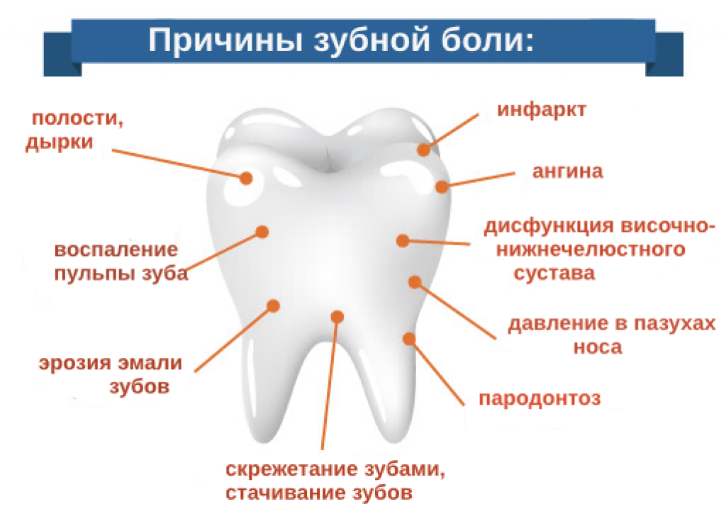 Как уменьшить боль в зубе. Зуб.